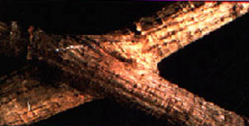 Root Grafts